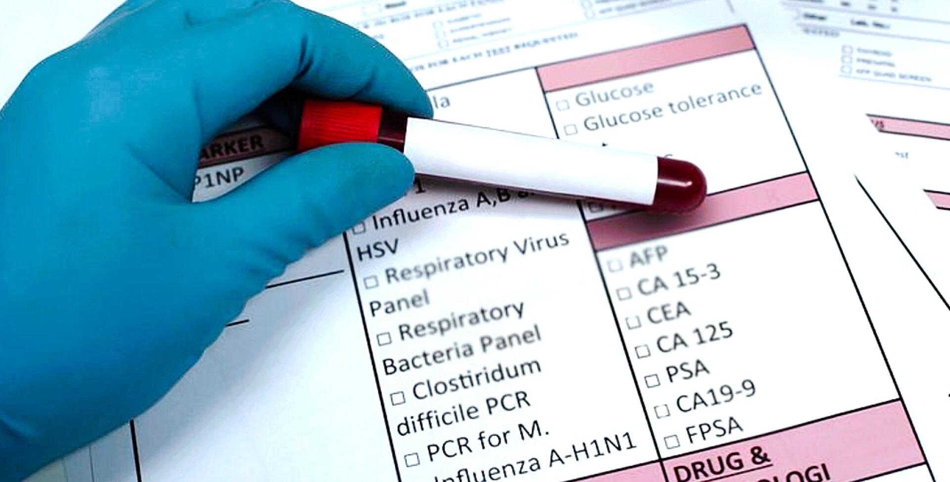 پزشک در حال بررسی نمونه خون برای تفسیر نتایج آزمایش